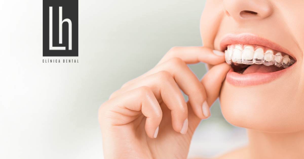 Paciente colocando alineador Invisalign, sistema de ortodoncia invisible - Clínica Dental Henríquez